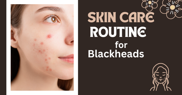 Best skin care routine for blackheads in 2026