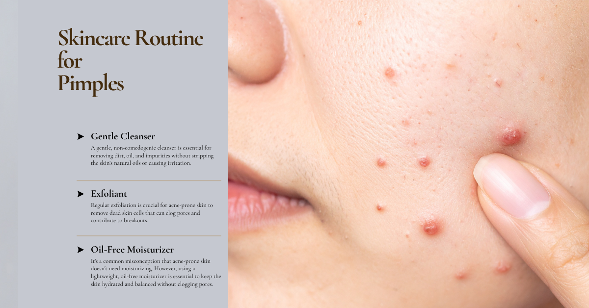 Best skincare routine for pimples in 2026