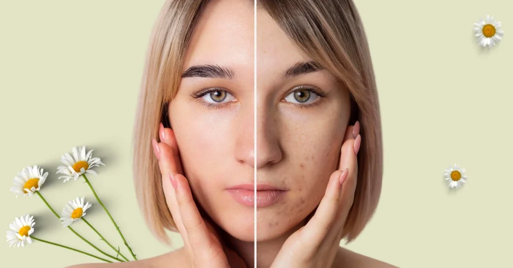 Best Oily Skin Morning Routine in 5 Minutes